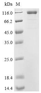 Greater than 90% as determined by SDS-PAGE.Recombinant Cynomolgus Monkey Cadherin 17 (CDH17) Protein (His), Active