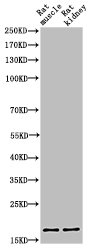 Western Blot analysis of RAT-KIDNEY RAT-MUSCLE cells using Acetyl-Histone H3 (K9) Polyclonal Antibody