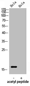 Western Blot analysis of hela using Acetyl-Histone H3 (K9) Polyclonal Antibody.