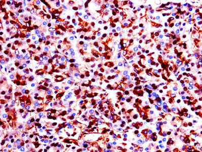 Immunohistochemistry of paraffin-embedded human pancreatic tissue using GAPDH Antibody at dilution of 1:100Rabbit anti-Human GAPDH Polyclonal Antibody