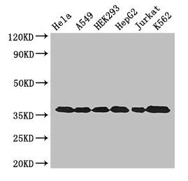 Western Blot  | Positive WB detected in: Hela whole cell lysate, A549 whole cell lysate, HEK293 whole cell lysate, HepG2 whole cell lysate, Jurkat whole cell lysate, K562 whole cell lysate  | All lanes: GAPDH antibody at 3µg/ml  | Secondary  | Goat polyclonal to rabbit IgG at 1/50000 dilution  | Predicted band size: 37, 32 kDa  | Observed band size: 37 kDaRabbit anti-Human GAPDH Polyclonal Antibody