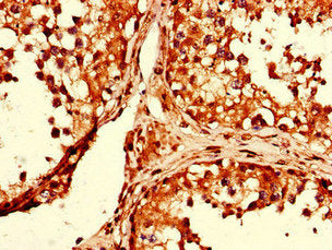 Immunohistochemistry of paraffin-embedded human testis tissue using GAPDH Antibody at dilution of 1:100Rabbit anti-Human GAPDH Polyclonal Antibody