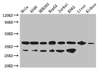 Western Blot | Positive WB detected in: Hela whole cell lysate, A549 whole cell lysate, HEK293 whole cell lysate, HepG2 whole cell lysate, Jurkat whole cell lysate, K562 whole cell lysate, Mouse liver tissue, Mouse kidney tissue | All lanes: GAPDH antibody at 2.5μg/ml | Secondary | Goat polyclonal to rabbit IgG at 1/50000 dilution | Predicted band size: 37, 32 kDa | Observed band size: 37, 32 kDaRabbit anti-Human GAPDH Polyclonal Antibody
