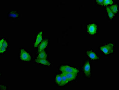 Immunofluorescent analysis of HepG2 cells using LDHA Antibody at dilution of 1:100 and Alexa Fluor 488-congugated AffiniPure Goat Anti-Rabbit IgG(H+L)