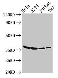 Western Blot  | Positive WB detected in: Hela whole cell lysate, A375 whole cell lysate, Jurkat whole cell lysate, 293 whole cell lysate  | All lanes: LDHA antibody at 3µg/ml  | Secondary  | Goat polyclonal to rabbit IgG at 1/50000 dilution  | Predicted band size: 37, 31, 40, 27 kDa  | Observed band size: 37 kDa