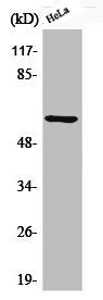Western Blot analysis of HeLa cells using Phospho-Akt1 (S246) Polyclonal AntibodyRabbit anti-Human Phospho-AKT1 (S246) Polyclonal Antibody