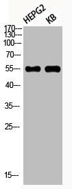 Western Blot analysis of HEPG2 KB using Phospho-Akt1 (S246) Polyclonal AntibodyRabbit anti-Human Phospho-AKT1 (S246) Polyclonal Antibody