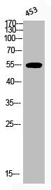 Western Blot analysis of 453 cells using Phospho-Akt1 (T450) Polyclonal AntibodyRabbit anti-Human Phospho-AKT1 (T450) Polyclonal Antibody