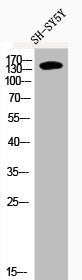 Western Blot analysis of SH-SY5Y cells using Phospho-IRS-1 (S636) Polyclonal AntibodyRabbit anti-Human Phospho-IRS1 (S636) Polyclonal Antibody