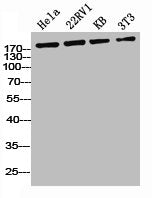 Western Blot analysis of HELA 22RV1 KB NIH-3T3 cells using Phospho-IRS-1 (S636) Polyclonal AntibodyRabbit anti-Human Phospho-IRS1 (S636) Polyclonal Antibody