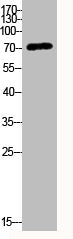 Western Blot analysis of various cells using Phospho-LIMK-1 (T508) Polyclonal AntibodyRabbit anti-Human Phospho-LIMK1 (T508) Polyclonal Antibody
