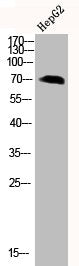 Western Blot analysis of HEPG2 using Phospho-LIMK-1 (T508) Polyclonal Antibody.Rabbit anti-Human Phospho-LIMK1 (T508) Polyclonal Antibody