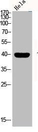 Western Blot analysis of HELA cells using Phospho-p38 (T180/Y182) Polyclonal AntibodyRabbit anti-Human Phospho-MAPK14 (T180/Y182) Polyclonal Antibody