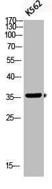 Western blot analysis of K562 lysis using Phospho-p38 (T180/Y182) antibody.Rabbit anti-Human Phospho-MAPK14 (T180/Y182) Polyclonal Antibody