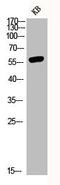 Western Blot analysis of KB using Phospho-Akt (Y326) Polyclonal AntibodyRabbit anti-Human Phospho-AKT1 (Y326) Polyclonal Antibody
