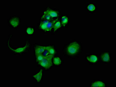 Immunofluorescence staining of MCF-7 cells with RPL11 Antibody at 1:83, counter-stained with DAPI. The cells were fixed in 4% formaldehyde, permeabilized using 0.2% Triton X-100 and blocked in 10% normal Goat Serum. The cells were then incubated with the antibody overnight at 4°C. The secondary antibody was Alexa Fluor 488-congugated AffiniPure Goat Anti-Rabbit IgG(H+L).Rabbit anti-Human RPL11 Polyclonal Antibody