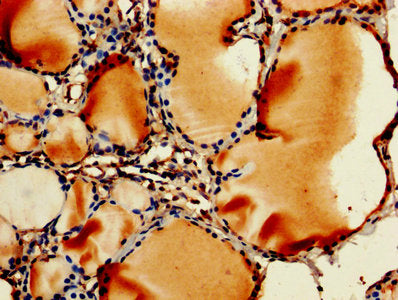 IHC image of the antibody diluted at 1:250 and staining in paraffin-embedded human thyroid tissue performed on a Leica BondTM system. After dewaxing and hydration, antigen retrieval was mediated by high pressure in a citrate buffer (pH 6.0). Section was blocked with 10% normal goat serum 30min at RT. Then primary antibody (1% BSA) was incubated at 4°C overnight. The primary is detected by a biotinylated secondary antibody and visualized using an HRP conjugated SP system.Rabbit anti-Human RPL11 Polyclonal Antibody