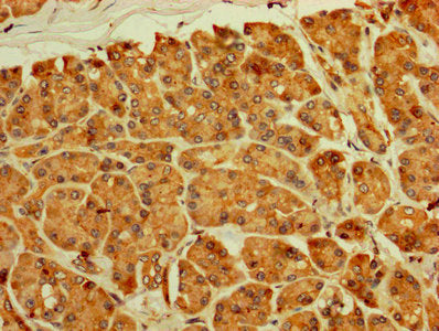 IHC image of RPL11 Antibody diluted at 1:250 and staining in paraffin-embedded human pancreatic tissue performed on a Leica BondTM system. After dewaxing and hydration, antigen retrieval was mediated by high pressure in a citrate buffer (pH 6.0). Section was blocked with 10% normal goat serum 30min at RT. Then primary antibody (1% BSA) was incubated at 4°C overnight. The primary is detected by a biotinylated secondary antibody and visualized using an HRP conjugated SP system.Rabbit anti-Human RPL11 Polyclonal Antibody