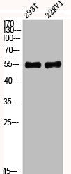 Western Blot analysis of 293T 22RV1 cells using Phospho-Akt1 (Y474) Polyclonal AntibodyRabbit anti-Human Phospho-AKT1 (Y474) Polyclonal Antibody