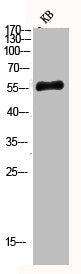 Western Blot analysis of KB using Phospho-Akt1 (Y474) Polyclonal AntibodyRabbit anti-Human Phospho-AKT1 (Y474) Polyclonal Antibody