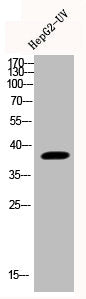 Western Blot analysis of HEPG2-UV cells using Phospho-p38 (Y323) Polyclonal AntibodyRabbit anti-Human Phospho-MAPK14 (Y323) Polyclonal Antibody