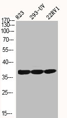 Western Blot analysis of 823 293-UV 22RV1 cells using Phospho-p38 (Y323) Polyclonal AntibodyRabbit anti-Human Phospho-MAPK14 (Y323) Polyclonal Antibody