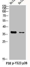 Western Blot analysis of HELA using Phospho-p38 (Y323) Polyclonal Antibody.Rabbit anti-Human Phospho-MAPK14 (Y323) Polyclonal Antibody