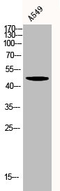 Western Blot analysis of A549 cells using Akt Polyclonal AntibodyRabbit anti-Human AKT1/AKT2/AKT3 Polyclonal Antibody