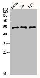 Western Blot analysis of HELA KB PC-3 using Akt1 Polyclonal Antibody.Rabbit anti-Human AKT1 Polyclonal Antibody