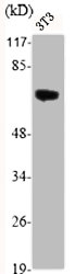 Western Blot analysis of NIH-3T3 cells using Akt Polyclonal AntibodyRabbit anti-Human AKT1/AKT2/AKT3 Polyclonal Antibody