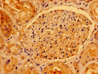 Immunohistochemistry of paraffin-embedded human kidney tissue using AACS Antibody at dilution of 1:100