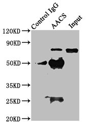 Immunoprecipitating AACS in HEK293 whole cell lysate  | Lane 1: Rabbit control IgG instead of AACS Antibody in HEK293 whole cell lysate. For western blotting, a HRP-conjugated Protein G antibody was used as the secondary antibody (1/2000)  | Lane 2: AACS Antibody (8µg) + HEK293 whole cell lysate (500µg)  | Lane 3: HEK293 whole cell lysate (10µg)