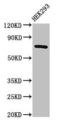 Western Blot  | Positive WB detected in: HEK293 whole cell lysate  | All lanes: AACS antibody at 2.5µg/ml  | Secondary  | Goat polyclonal to rabbit IgG at 1/50000 dilution  | Predicted band size: 76, 68, 31 kDa  | Observed band size: 76 kDa