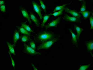 Immunofluorescence staining of Hela cells with AARS Antibody at 1:33, counter-stained with DAPI. The cells were fixed in 4% formaldehyde, permeabilized using 0.2% Triton X-100 and blocked in 10% normal Goat Serum. The cells were then incubated with the antibody overnight at 4°C. The secondary antibody was Alexa Fluor 488-congugated AffiniPure Goat Anti-Rabbit IgG(H+L).Rabbit anti-Human AARS Polyclonal Antibody