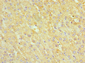 Immunohistochemistry of paraffin-embedded human liver tissue using ABAT Antibody at dilution of 1:100