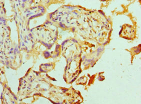 Immunohistochemistry of paraffin-embedded human placenta tissue using ABAT Antibody at dilution of 1:100