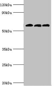 Western blot | All lanes: 4-aminobutyrate aminotransferase, mitochondrial antibody at 10μg/ml | Lane 1: Rat liver tissue | Lane 2: Mouse pancreatic tissue | Lane 3: Mouse kidney tissue | Secondary | Goat polyclonal to rabbit IgG at 1/10000 dilution | Predicted band size: 56 kDa | Observed band size: 56 kDa