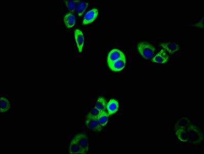 Immunofluorescence staining of PC-3 cells with ABCC5 Antibody at 1:133, counter-stained with DAPI. The cells were fixed in 4% formaldehyde, permeabilized using 0.2% Triton X-100 and blocked in 10% normal Goat Serum. The cells were then incubated with the antibody overnight at 4°C. The secondary antibody was Alexa Fluor 488-congugated AffiniPure Goat Anti-Rabbit IgG(H+L).