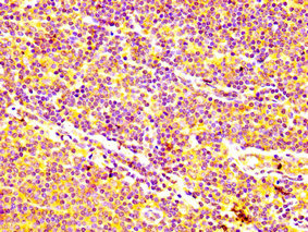 IHC image of the antibody diluted at 1:400 and staining in paraffin-embedded human lymph node tissue performed on a Leica BondTM system. After dewaxing and hydration, antigen retrieval was mediated by high pressure in a citrate buffer (pH 6.0). Section was blocked with 10% normal goat serum 30min at RT. Then primary antibody (1% BSA) was incubated at 4°C overnight. The primary is detected by a biotinylated secondary antibody and visualized using an HRP conjugated SP system.