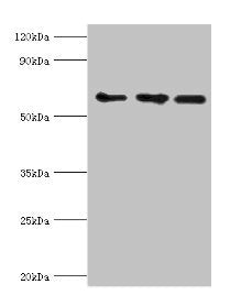 Western blot | All lanes: ABCE1 antibody at 4μg/ml | Lane 1: 293T whole cell lysate | Lane 2: Hela whole cell lysate | Lane 3: k562 whole cell lysate | Secondary | Goat polyclonal to rabbit IgG at 1/10000 dilution | Predicted band size: 67 kDa | Observed band size: 67 kDa