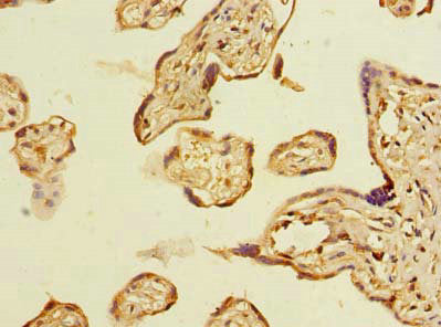 Immunohistochemistry of paraffin-embedded human placenta tissue using ABHD2 Antibody at dilution of 1:100
