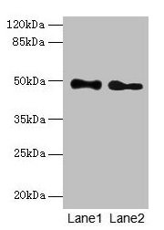 Western blot  | All lanes: ABHD2 antibody at 10µg/ml  | Lane 1: Mouse heart tissue  | Lane 2: Rat gonadal tissue  | Secondary  | Goat polyclonal to rabbit IgG at 1/10000 dilution  | Predicted band size: 49 kDa  | Observed band size: 49 kDa