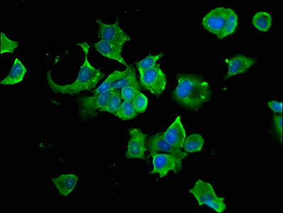 Immunofluorescence staining of MCF-7 cells with HSP90AB1 Antibody at 1:66, counter-stained with DAPI. The cells were fixed in 4% formaldehyde, permeabilized using 0.2% Triton X-100 and blocked in 10% normal Goat Serum. The cells were then incubated with the antibody overnight at 4°C. The secondary antibody was Alexa Fluor 488-congugated AffiniPure Goat Anti-Rabbit IgG(H+L).Rabbit anti-Human HSP90AB1 Polyclonal Antibody