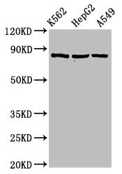 Western Blot  | Positive WB detected in: K562 whole cell lysate, HepG2 whole cell lysate, A549 whole cell lysate  | All lanes: HSP90AB1 antibody at 2µg/ml  | Secondary  | Goat polyclonal to rabbit IgG at 1/50000 dilution  | Predicted band size: 84 kDa  | Observed band size: 84 kDaRabbit anti-Human HSP90AB1 Polyclonal Antibody