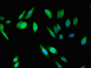 Immunofluorescent analysis of Hela cells using ABI2 Antibody at dilution of 1:100 and Alexa Fluor 488-congugated AffiniPure Goat Anti-Rabbit IgG(H+L)