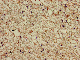 Immunohistochemistry of paraffin-embedded human brain tissue using the antibody at dilution of 1:100