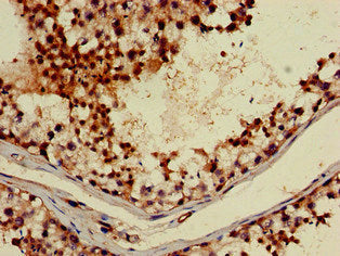 Immunohistochemistry of paraffin-embedded human testis tissue using ABI2 Antibody at dilution of 1:100