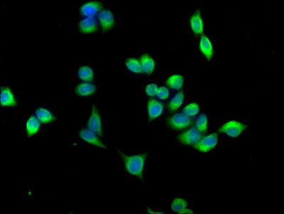 Immunofluorescence staining of PC-3 cells with ABLIM3 Antibody at 1:166,counter-stained with DAPI. The cells were fixed in 4% formaldehyde, permeabilized using 0.2% Triton X-100 and blocked in 10% normal Goat Serum. The cells were then incubated with the antibody overnight at 4°C.The secondary antibody was Alexa Fluor 488-congugated AffiniPure Goat Anti-Rabbit IgG (H+L).Rabbit anti-Human ABLIM3 Polyclonal Antibody