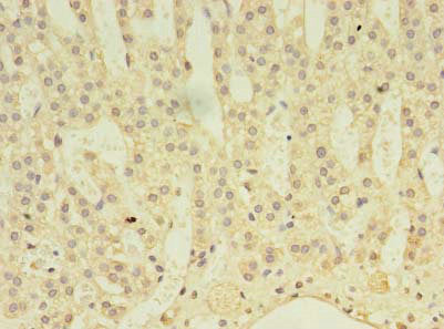 Immunohistochemistry of paraffin-embedded human adrenal gland tissue using the antibody at dilution of 1:100Rabbit anti-Human ABLIM3 Polyclonal Antibody