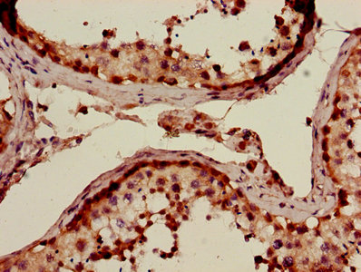 Immunohistochemistry of paraffin-embedded human testis tissue using ABLIM3 Antibody at dilution of 1:100Rabbit anti-Human ABLIM3 Polyclonal Antibody
